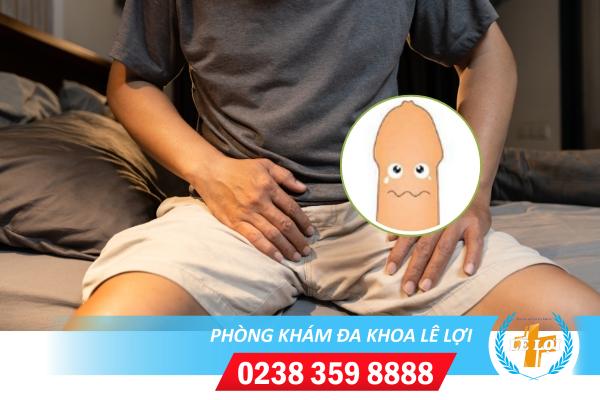 Địa chỉ hỗ trợ chữa hẹp bao quy đầu tốt tại Nghệ An
