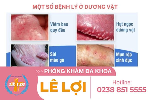 Những căn bệnh đáng sợ ở dương vật mà nam giới cần cẩn thận