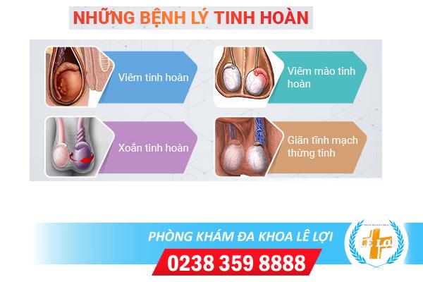Những kiến thức cần biết về các căn bệnh ở tinh hoàn