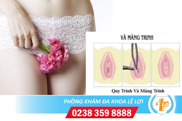 Chi phí vá màng trinh hết bao nhiêu tiền tại Vinh – Nghệ An?