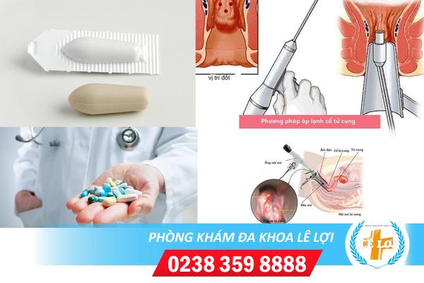 Phương pháp hỗ trợ điều trị viêm lộ tuyến cổ tử cung hiệu quả