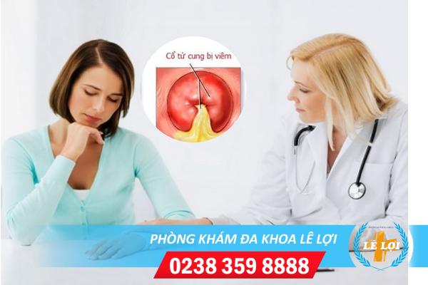 Địa chỉ hỗ trợ điều trị viêm cổ tử cung ở uy tín tại Nghệ An