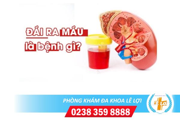 Đái ra máu – Cẩn thận với những bệnh lý nguy hiểm