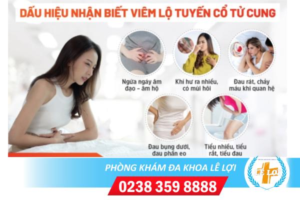 Phương pháp hỗ trợ chữa viêm lộ tuyến cổ tử cung hiệu quả