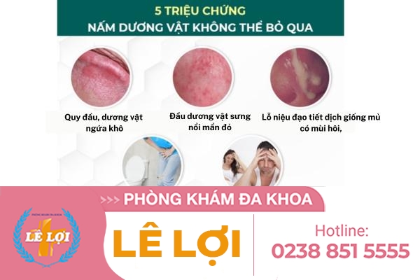 Những nguy hiểm từ triệu chứng nấm dương vật ở nam giới