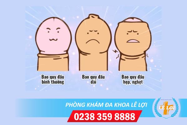 Những cách hỗ trợ chữa hẹp bao quy đầu hiệu quả cho nam giới