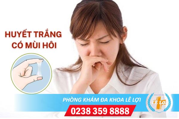 Huyết trắng có mùi hôi phải làm sao?