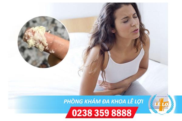 Huyết trắng vón cục là dấu hiệu bệnh gì ?
