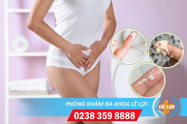 Mối nguy hiểm khó lường khi huyết trắng vón cục