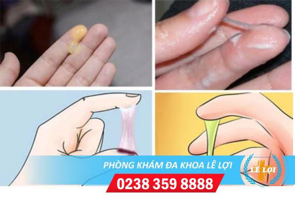 Cảnh giác với thay đổi màu sắc bất thường của huyết trắng phụ khoa