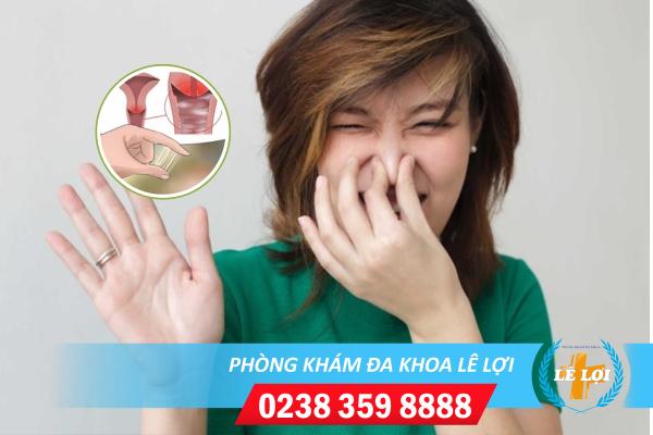 Hỗ trợ chữa khí hư có mùi như thế nào hiệu quả