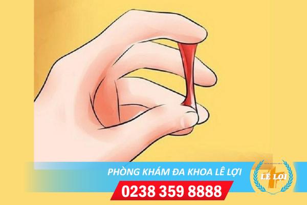 Khí Hư Màu Đỏ: Dấu Hiệu Bệnh Lý Nguy Hiểm Ở Nữ Giới