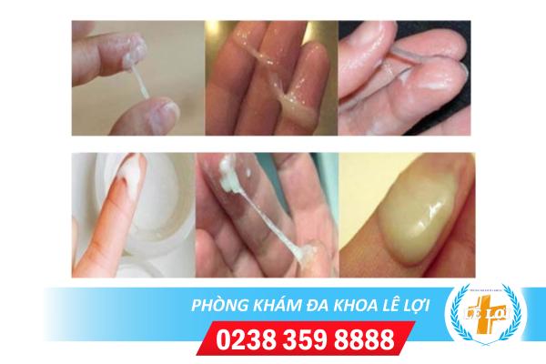 Khí hư màu trắng có nguy hiểm không?