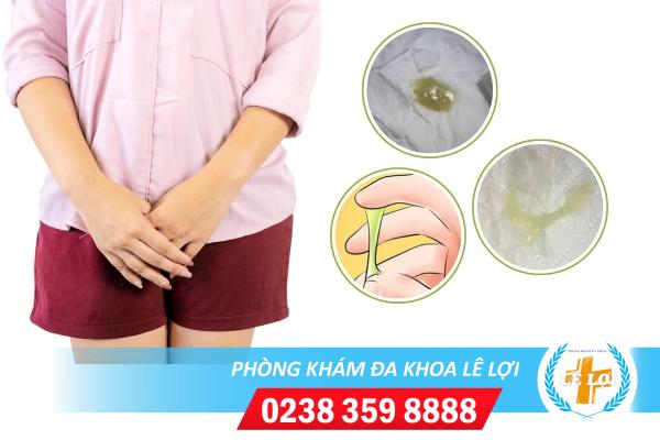 Khí hư màu xanh như nước mũi liệu nguy hiểm như thế nào?