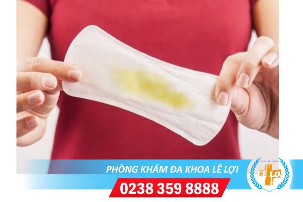 Khí hư ra nhiều có màu vàng – Nguyên nhân và cách hỗ trợ điều trị ra sao?