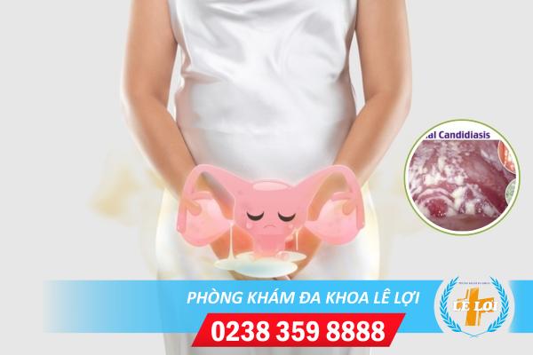 Nấm Candida – nguyên nhân gây nhiều bệnh lý nguy hiểm