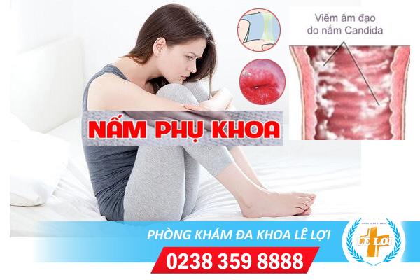 Triệu chứng nhận biết bệnh nấm phụ khoa