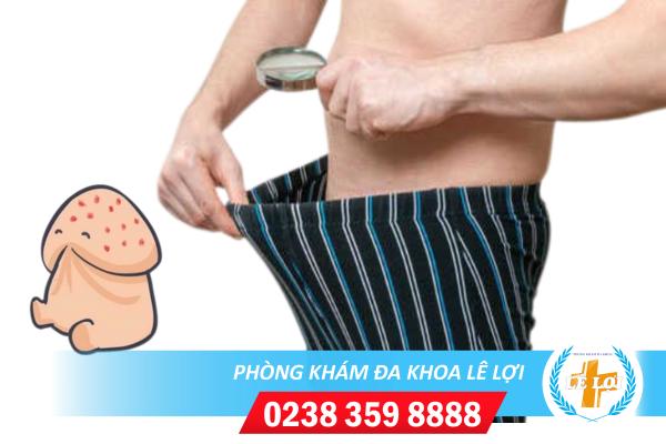Ngứa bao quy đầu – triệu chứng nam giới cần phải đề phòng