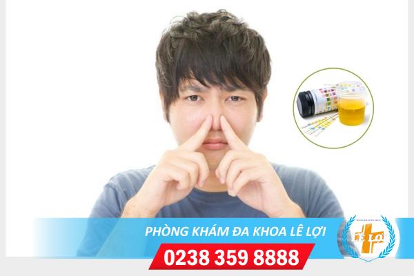 Nguyên nhân nước tiểu có mùi hôi và phương pháp hỗ trợ điều trị