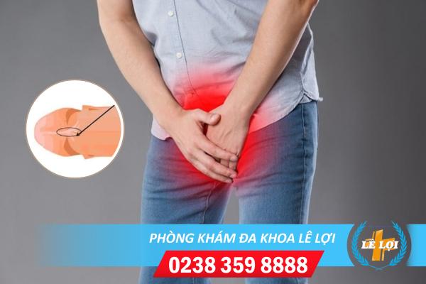 Khi bị rách bao quy đầu cần xử lý thế nào?