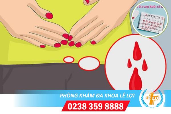 Bệnh rong kinh và những điều cần biết, dành cho chị em