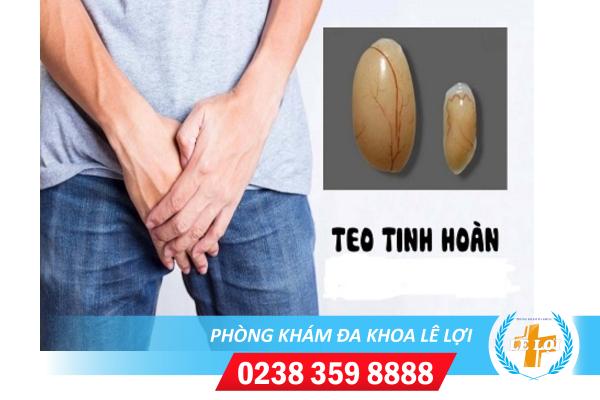 Nguy cơ mất cơ hội làm cha khi bị teo tinh hoàn
