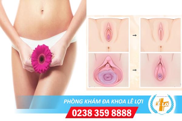 Địa chỉ thu hẹp tầng sinh môn uy tín tại Vinh – Nghệ An