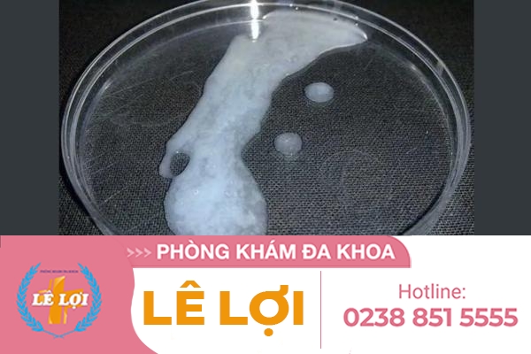 Tinh trùng vón cục ở nam giới là như thế nào ?