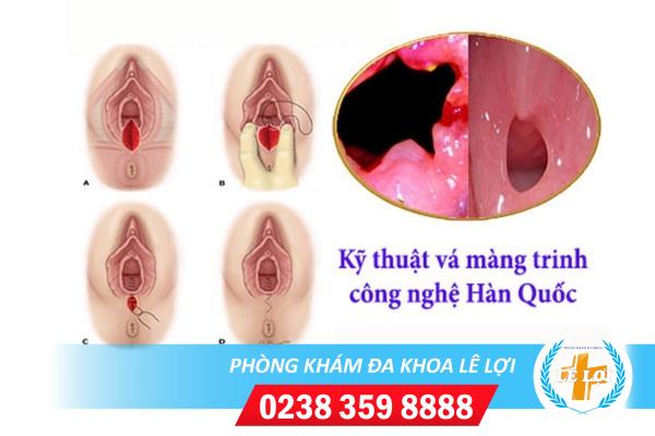 va-mang-trinh-cong-nghe-han-quoc (1)