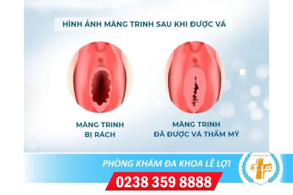 va-mang-trinh-cong-nghe-moi (1)
