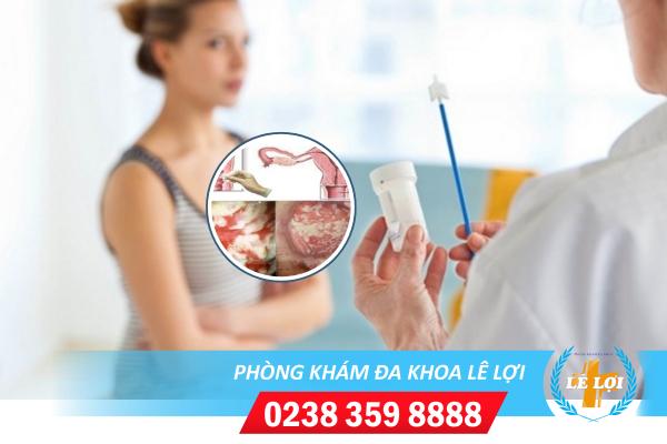 Viêm âm đạo hỗ trợ điều trị ở đâu uy tín tại Nghệ An?