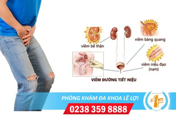 Viêm tiết niệu ở nam và nữ