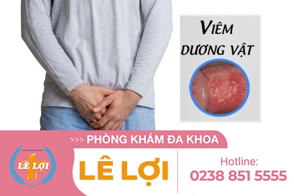 Viêm dương vật – Một trong những triệu chứng nam khoa đáng sợ
