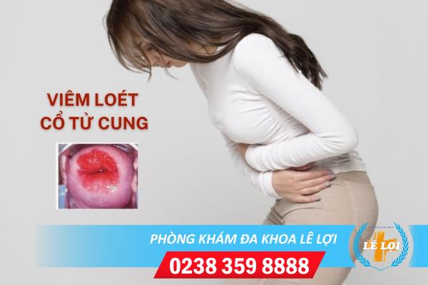 Dấu hiệu viêm loét cổ tử cung và cách điều trị hiệu quả