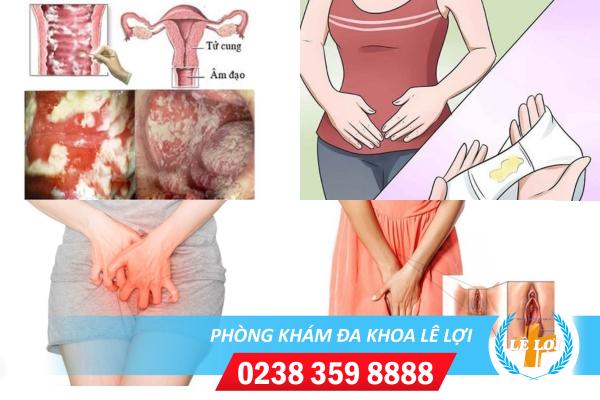 Viêm ngứa phụ khoa là bị bệnh gì?