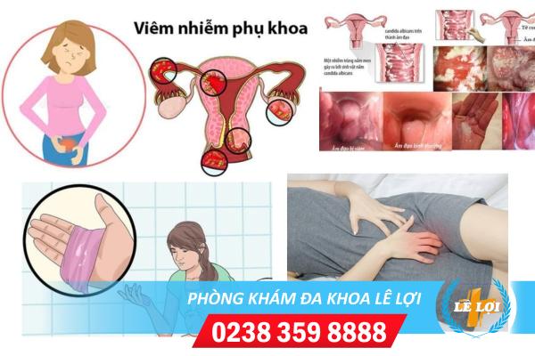 Nguyên nhân dẫn đến viêm phụ khoa là gì?