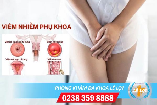 Địa chỉ hỗ trợ điều trị viêm nhiễm phụ khoa chất lượng tại Vinh – Nghệ An
