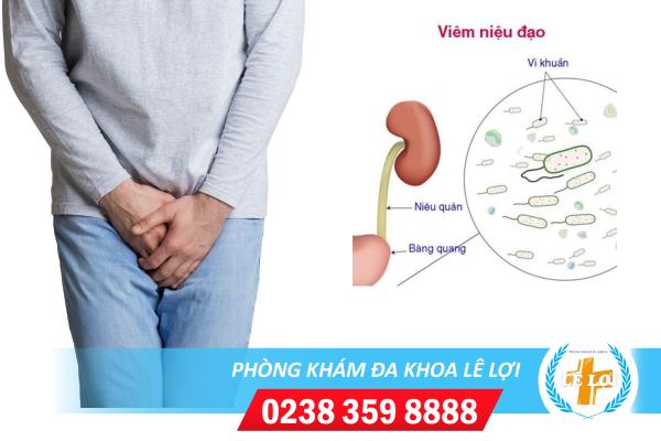 Những điều cần biết về viêm niệu đạo ở nam giới