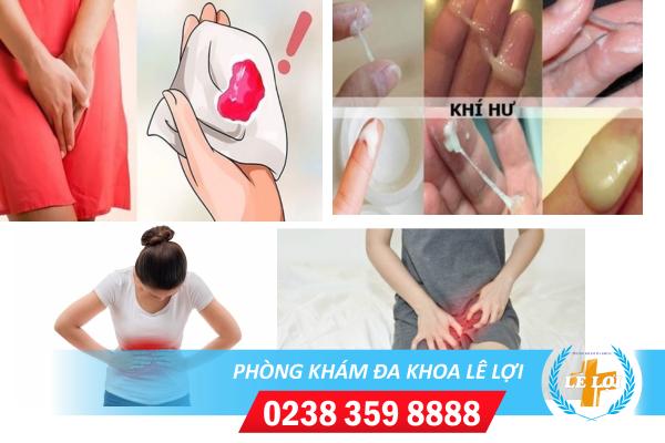 Hiện tượng bị viêm nhiễm phụ khoa nữ giới cần biết sớm