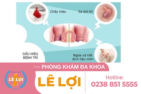 Cách chữa bệnh trĩ hiệu quả không lo tái phát