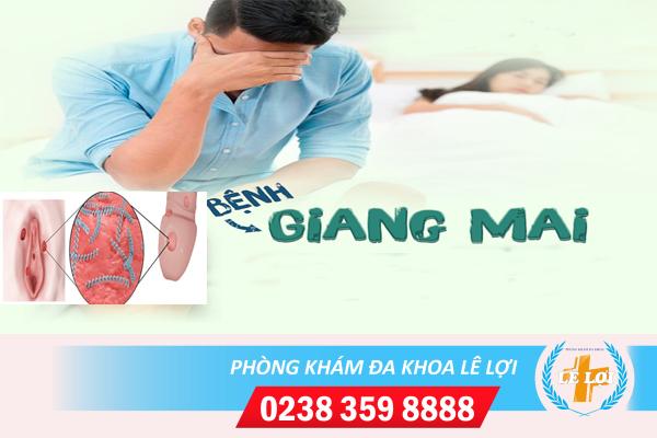 Nguyên nhân gây nên bệnh giang mai