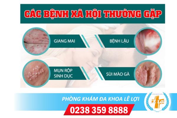 Phòng Khám Da Liễu Chuyên Chữa Bệnh Xã Hội