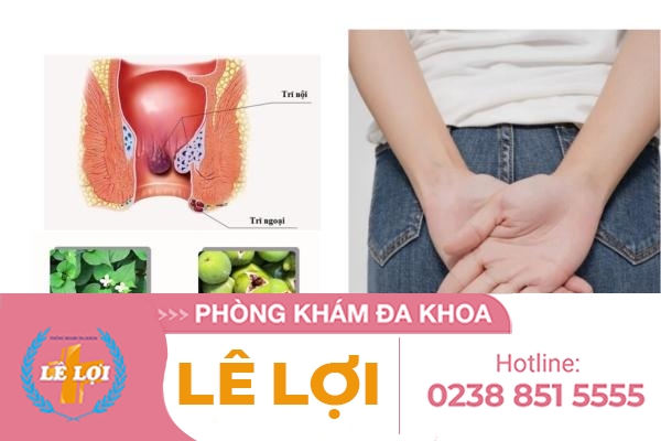 Chữa trĩ tại nhà có hiệu quả?