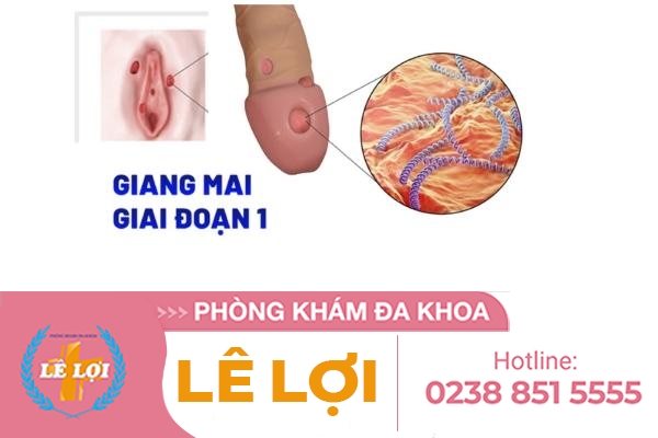 giang-mai-giai-doan-1 (1)