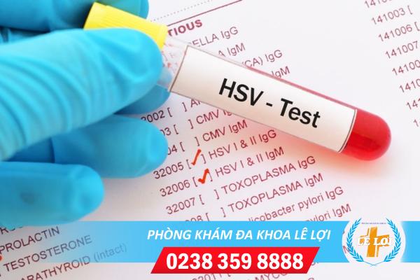 Khám chữa và xét nghiệm mụn rộp sinh dục ở đâu hiệu quả?