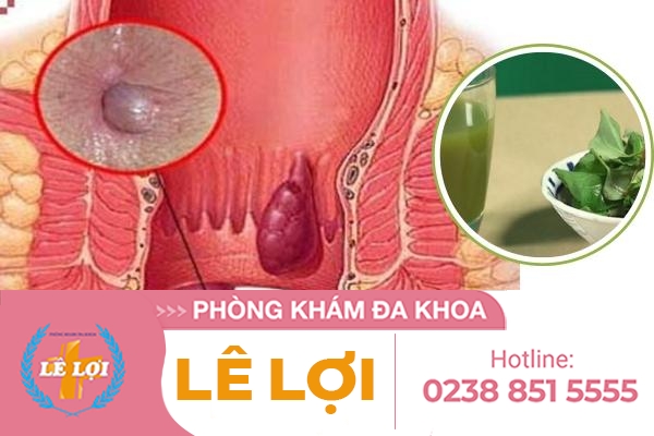 Chữa trĩ bằng mẹo tại nhà có hiệu quả?