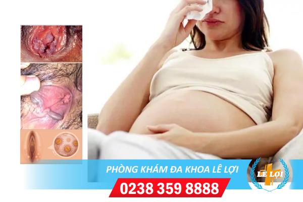 Sùi mào gà khi đang mang thai dấu hiệu và cách điều trị