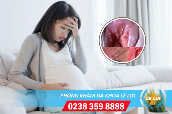 Sùi mào gà khi đang mang thai dấu hiệu và cách điều trị