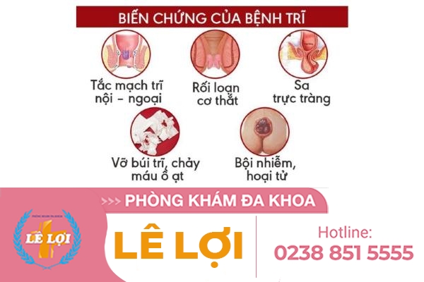 Các phương pháp điều trị bệnh trĩ an toàn, hiệu quả