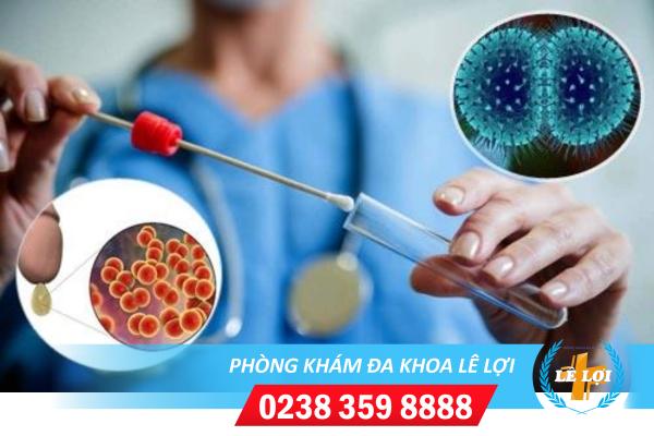 Chi phí xét nghiệm bệnh lậu có đắt không?